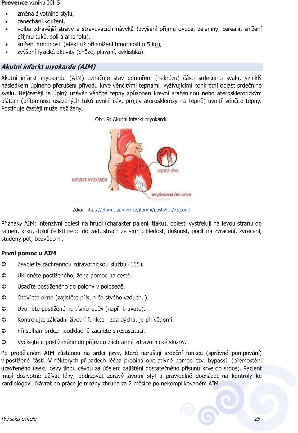 Akutní infarkt myokardu (AIM) Akutní infarkt myokardu (AIM) oznauje stav odumení (nekrózu) ásti srdeního svalu, vzniklý následkem úplného perušení pívodu krve vnitými tepnami, vyživujícími konkrétní