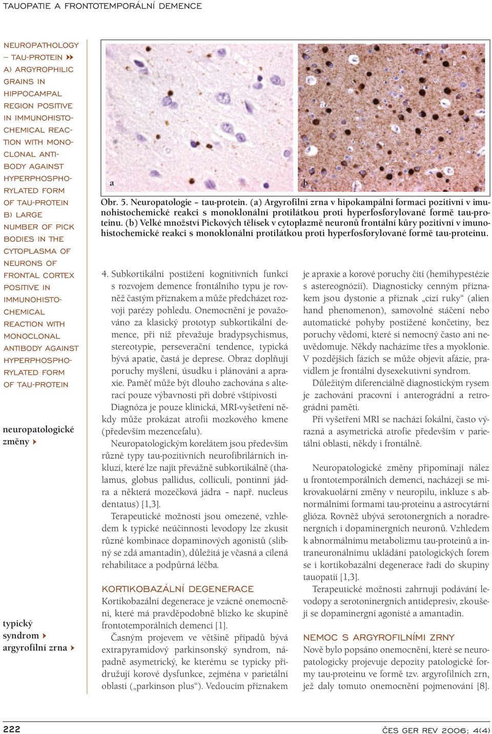 neuropatologické změny typický syndrom argyrofilní zrna a Obr. 5. Neuropatologie tau-protein.
