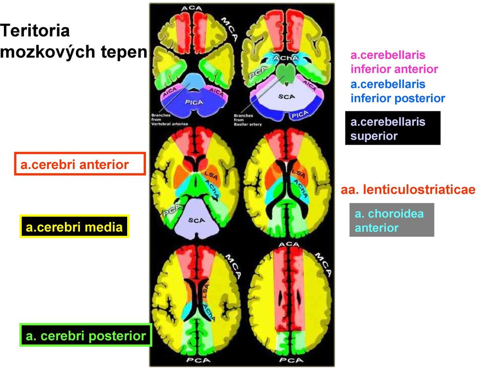 cerebellaris inferior posterior a.