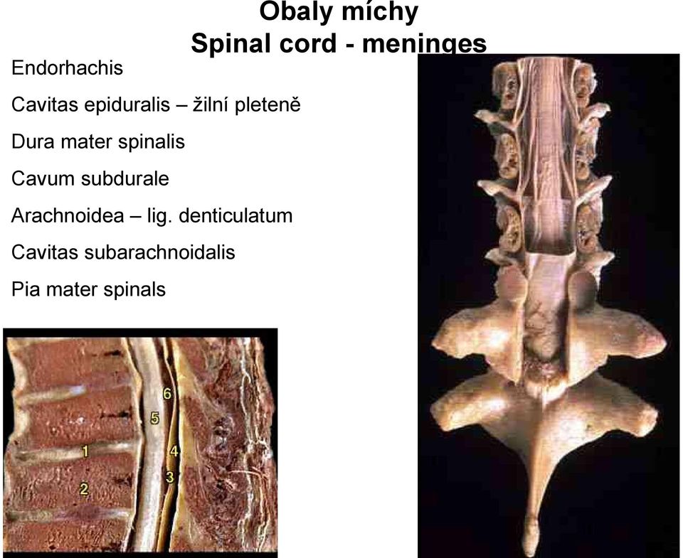 spinalis Cavum subdurale Arachnoidea lig.