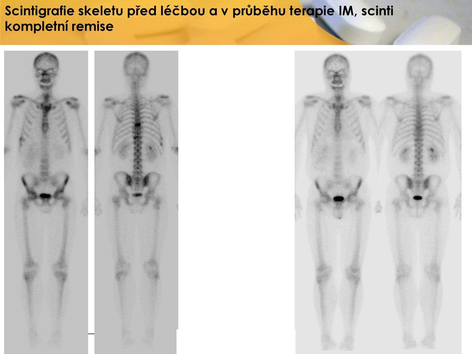 a v průběhu terapie