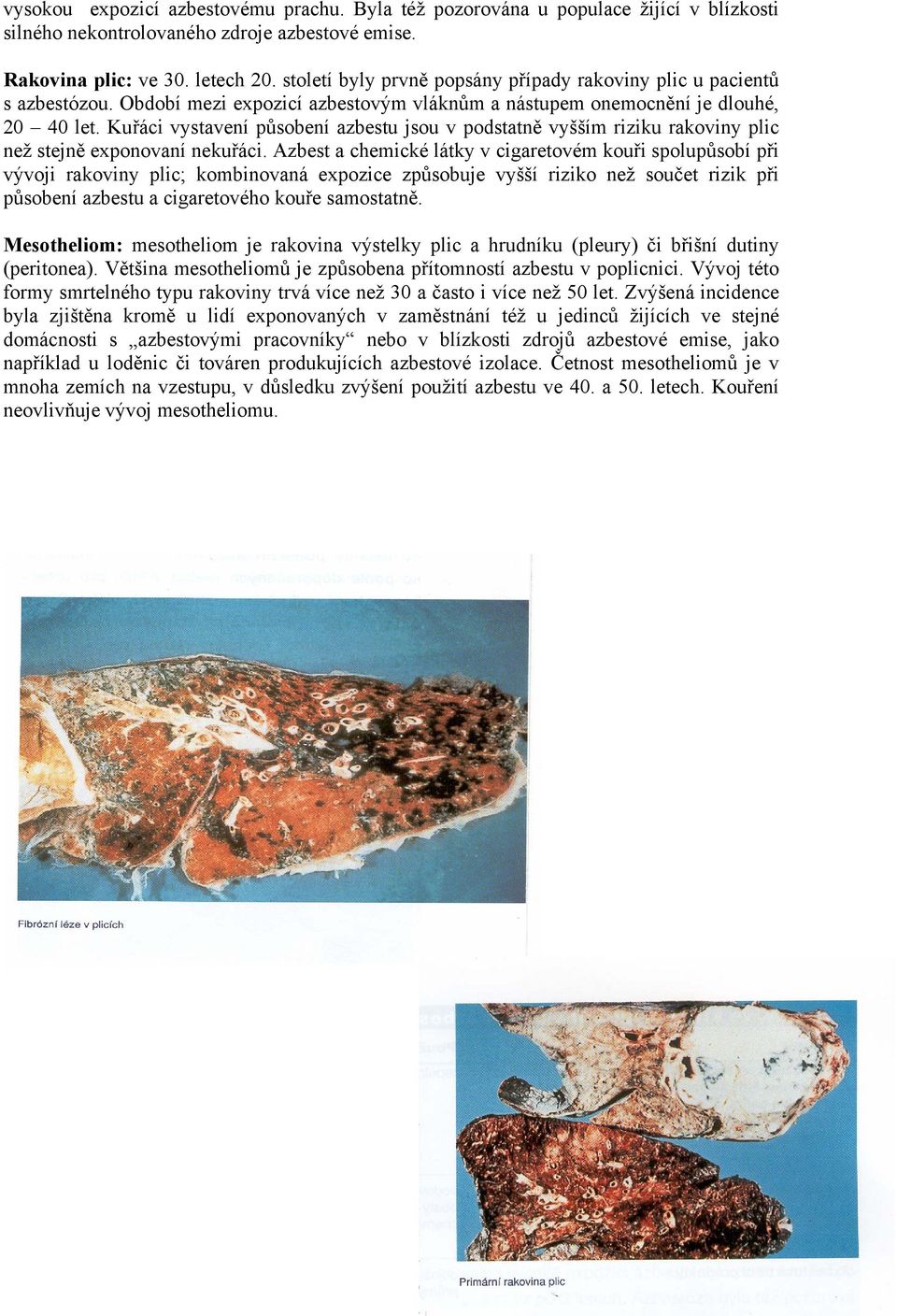 Kuřáci vystavení působení azbestu jsou v podstatně vyšším riziku rakoviny plic než stejně exponovaní nekuřáci.