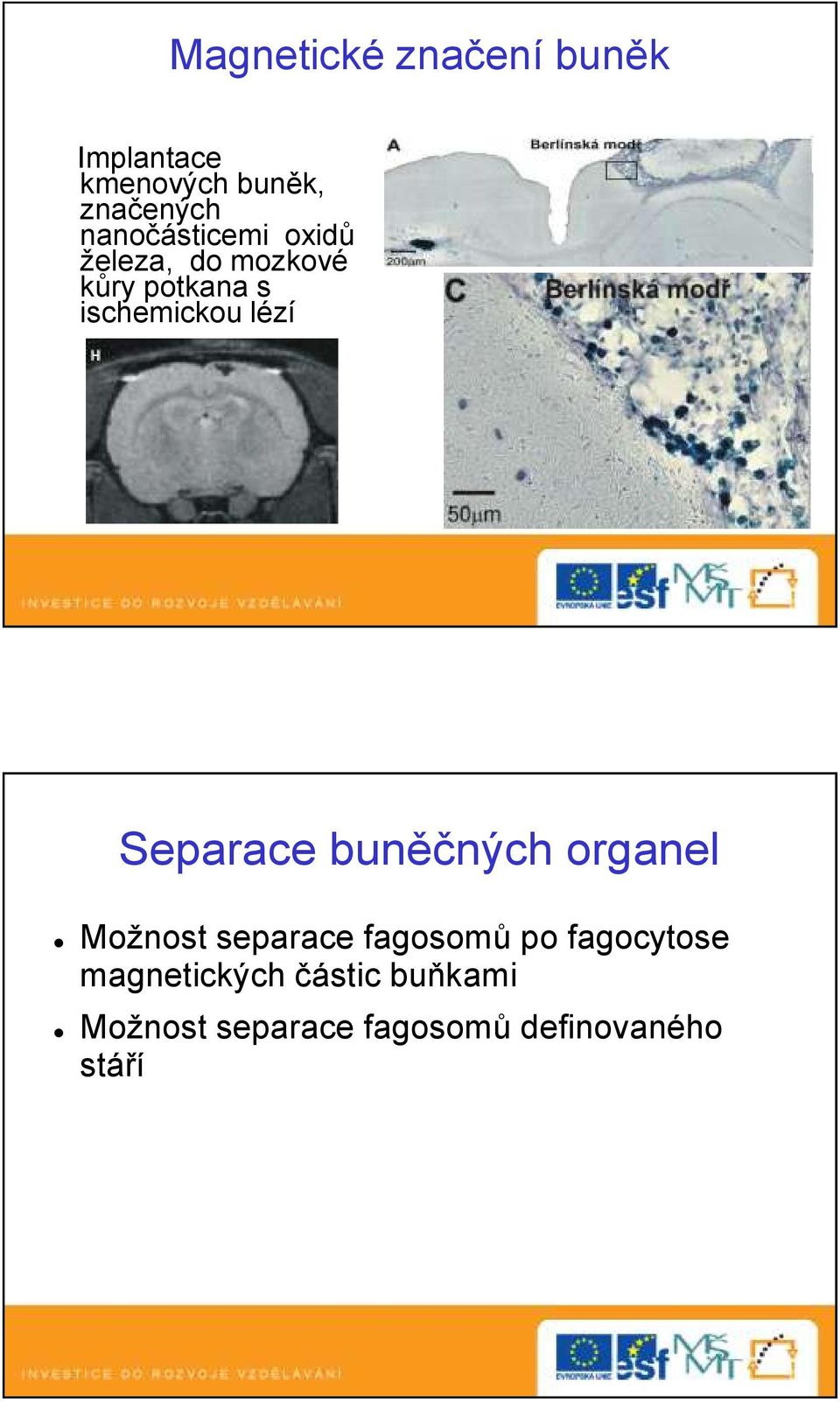 lézí Separace buněčných organel Možnost separace fagosomů po