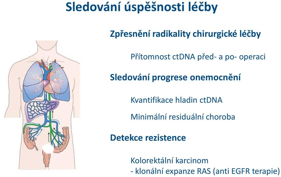 Kvantifikace hladin ctdna Minimální residuální choroba Detekce