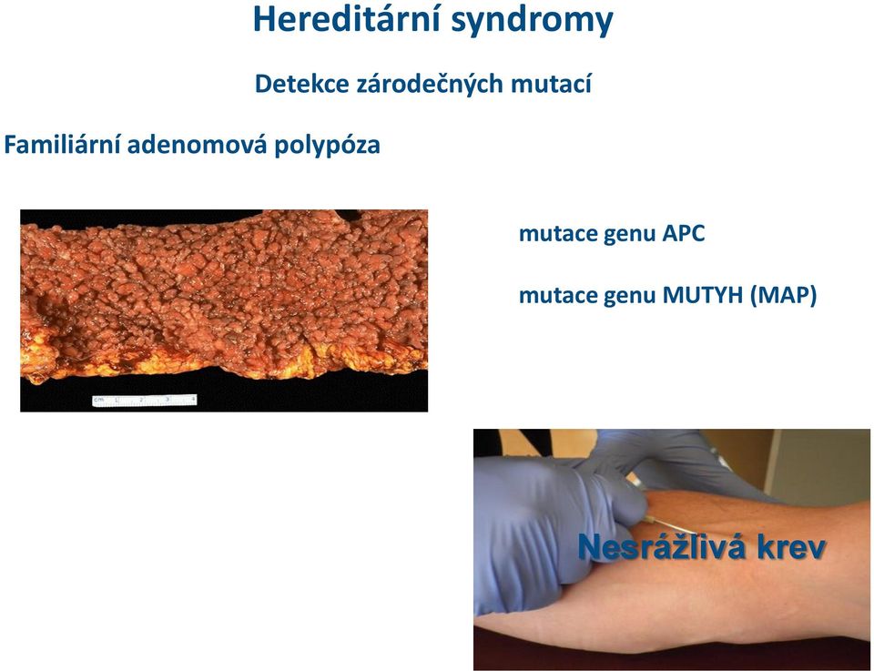 zárodečných mutací mutace genu