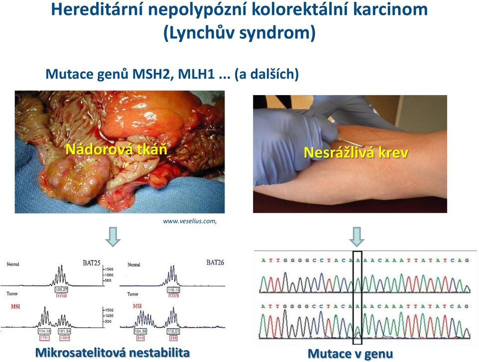 .. (a dalších) Nádorová tkáň Nesrážlivá krev www.