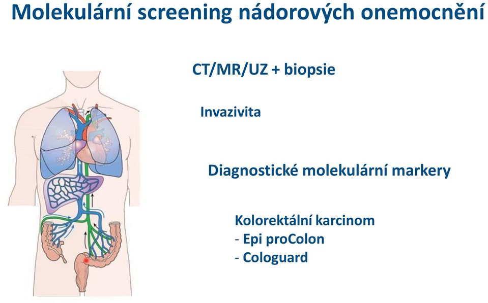 Invazivita Diagnostické molekulární