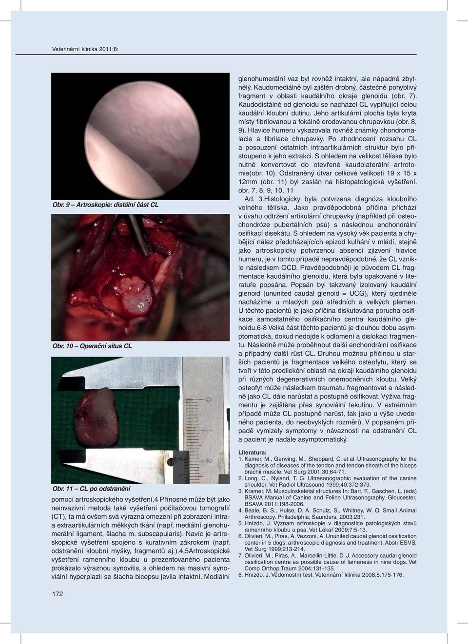 mediální glenohumerální ligament, šlacha m. subscapularis).