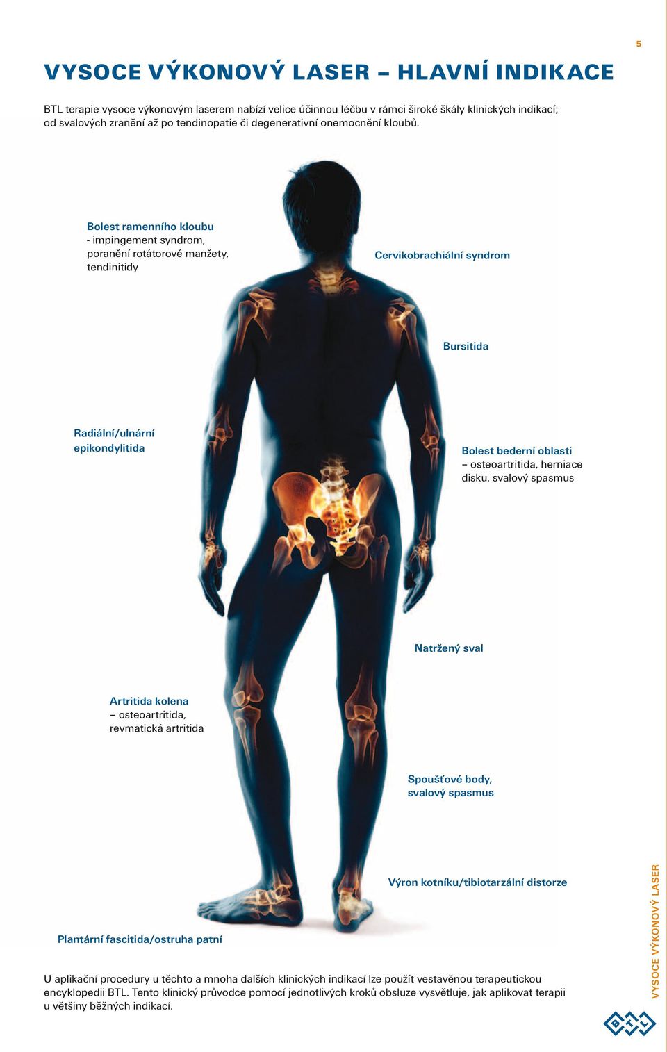 Bolest ramenního kloubu - impingement syndrom, poranění rotátorové manžety, tendinitidy Cervikobrachiální syndrom Bursitida Radiální/ulnární epikondylitida Bolest bederní oblasti osteoartritida,