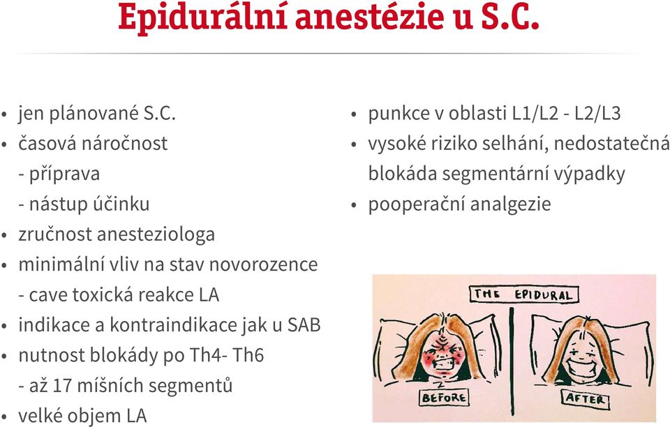 časová náročnost - příprava - nástup účinku zručnost anesteziologa minimální vliv na stav