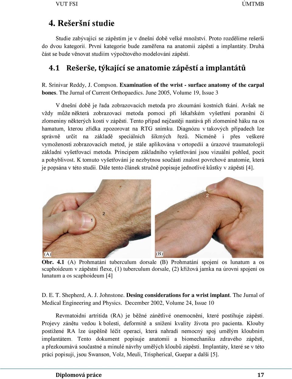 Examination of the wrist - surface anatomy of the carpal bones. The Jurnal of Current Orthopaedics.