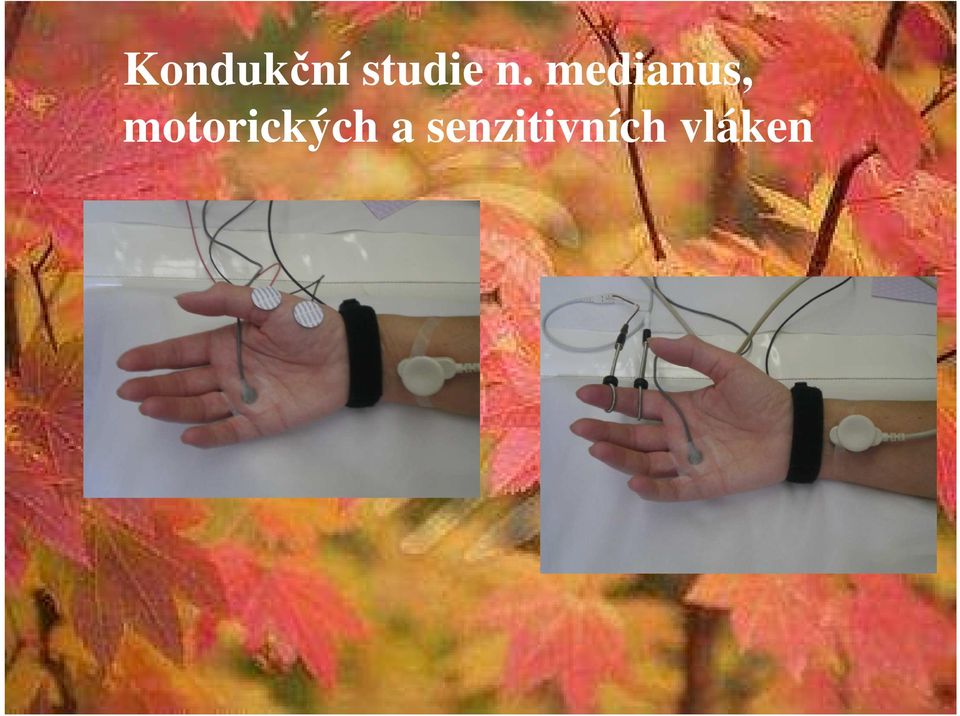 medianus,
