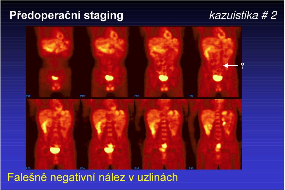 kazuistika # 2?