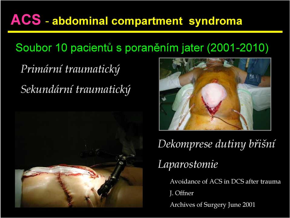 traumatický Dekomprese dutiny břišní Laparostomie Avoidance