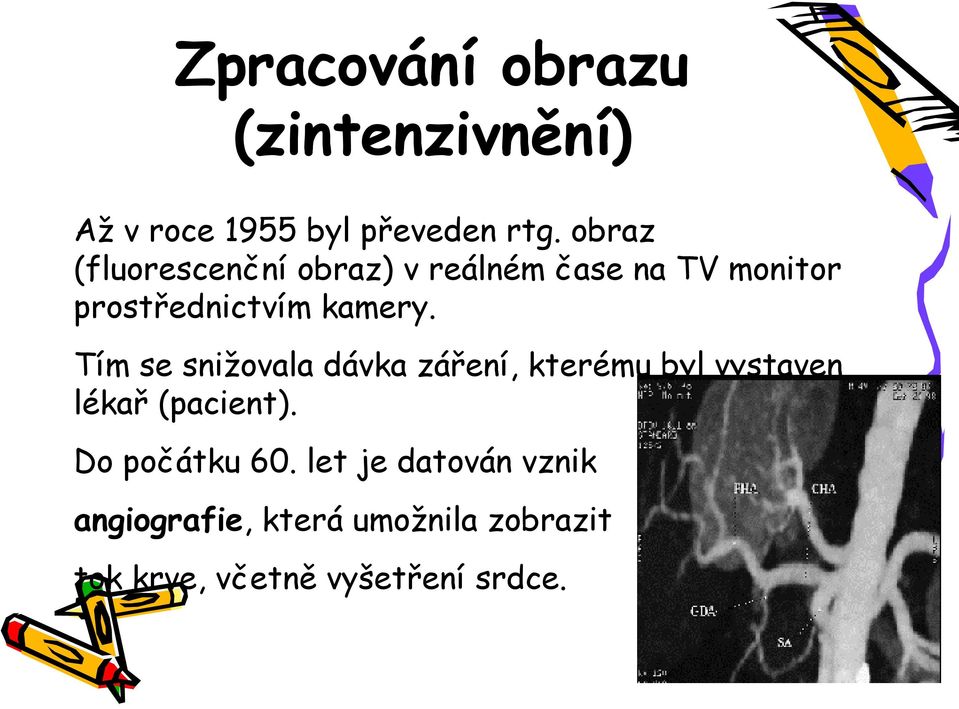 Tím se snižovala dávka záření, kterému byl vystaven lékař (pacient).