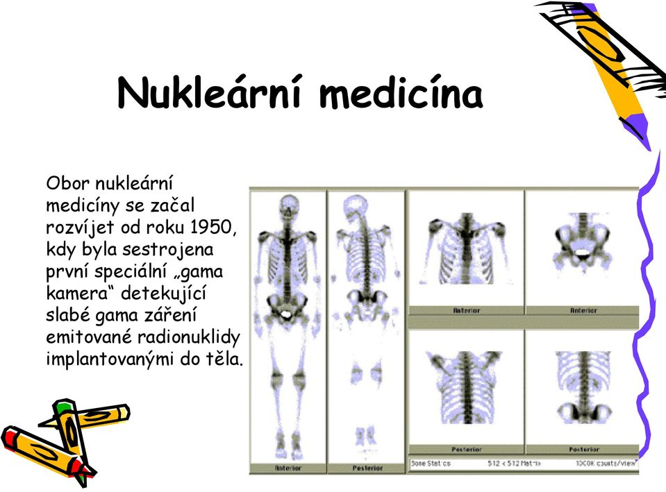 první speciální gama kamera detekující slabé gama