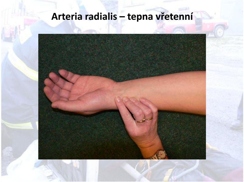 tepna