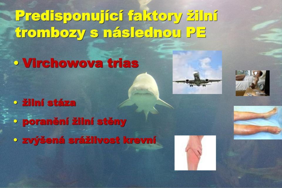 Virchowova trias žilní stáza