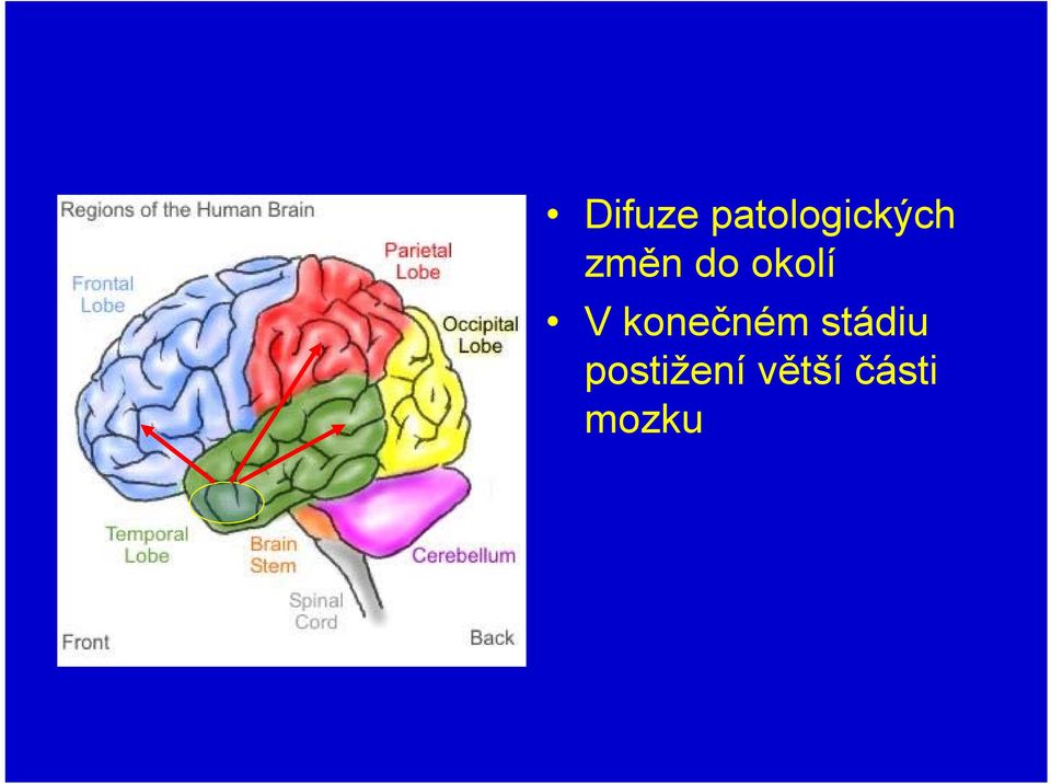 mozku   mozku