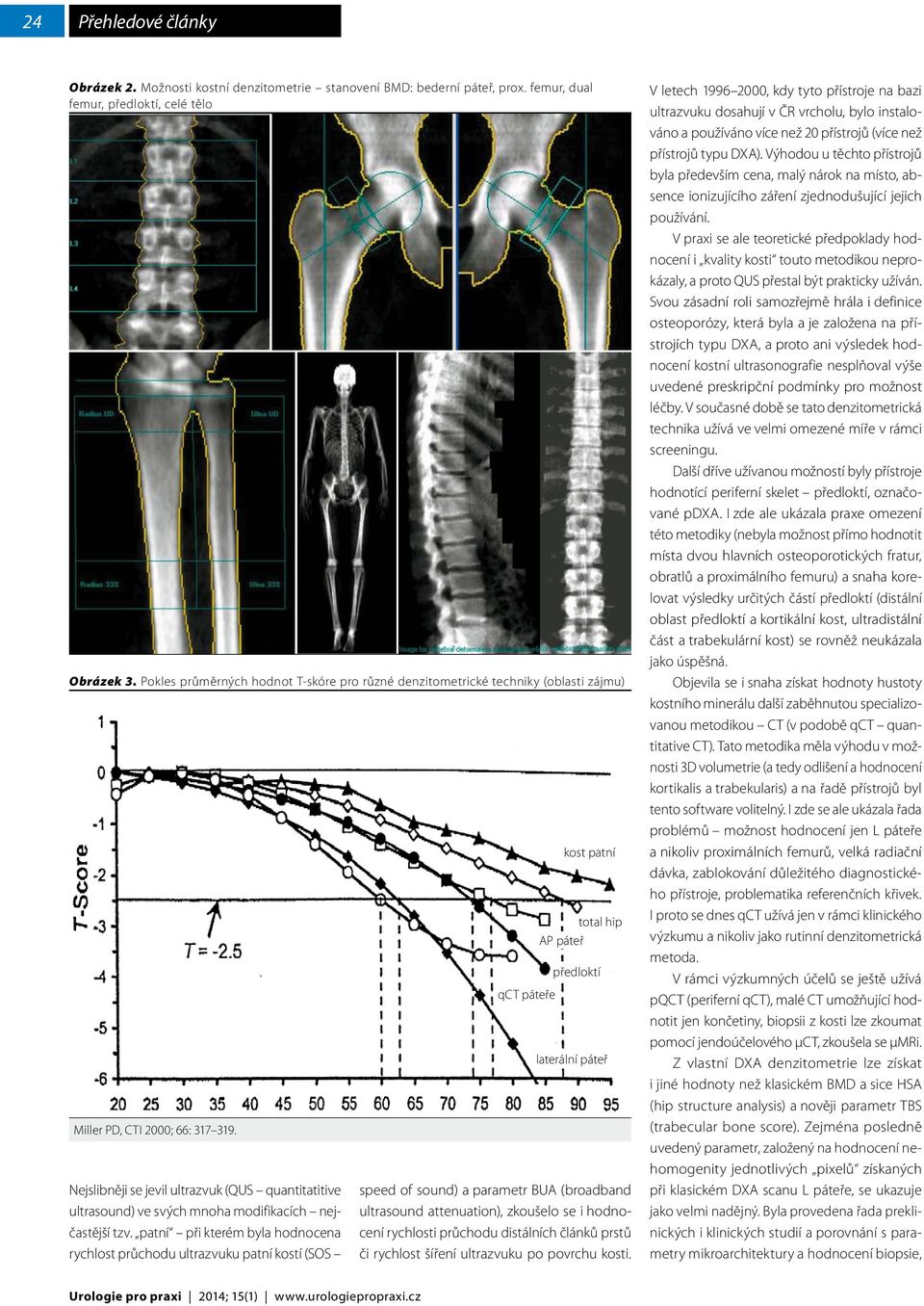 Nejslibněji se jevil ultrazvuk (QUS quantitatitive ultrasound) ve svých mnoha modifikacích nejčastější tzv.