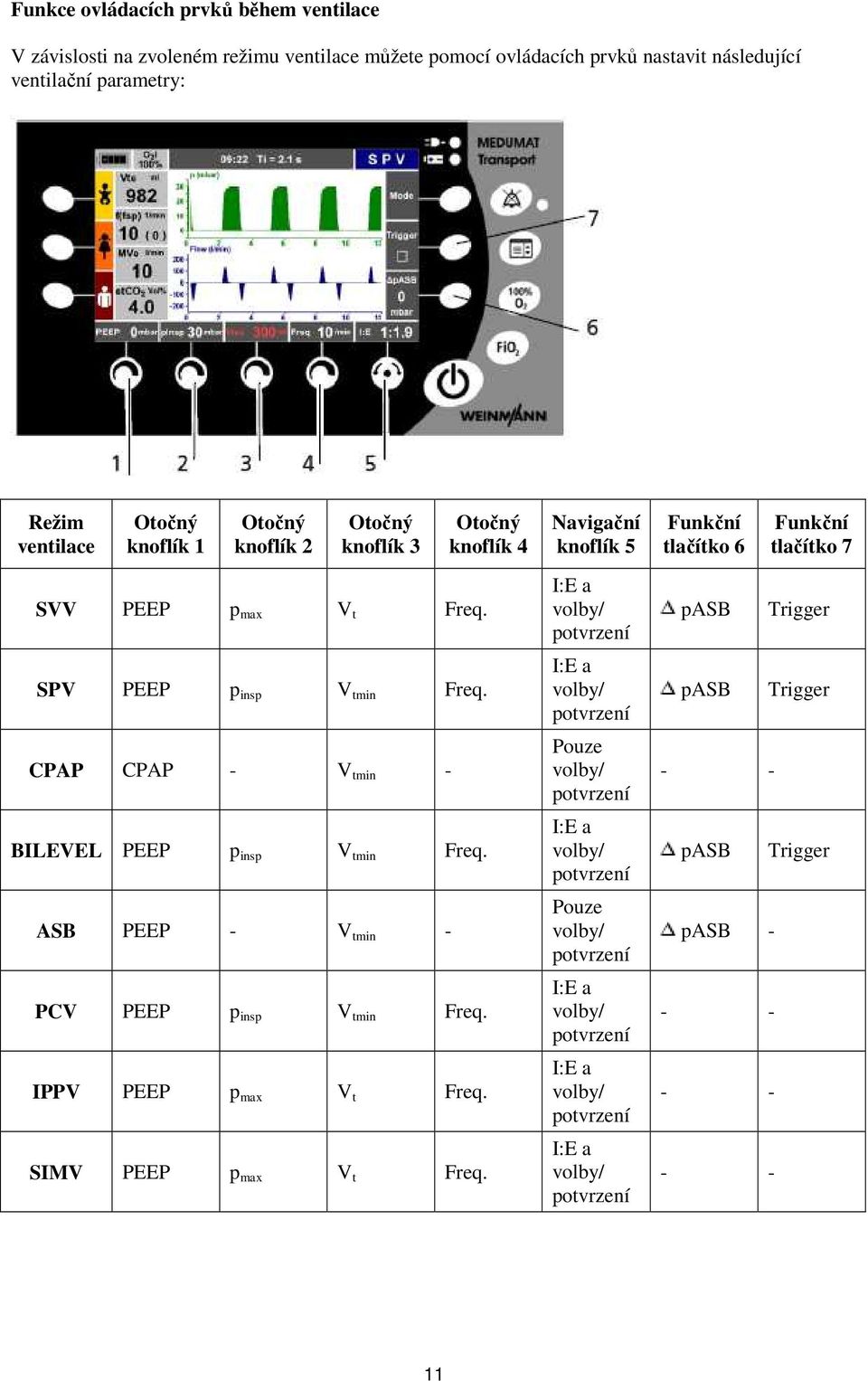 ASB PEEP - V tmin - PCV PEEP p insp V tmin Freq. IPPV PEEP p max V t Freq. SIMV PEEP p max V t Freq.