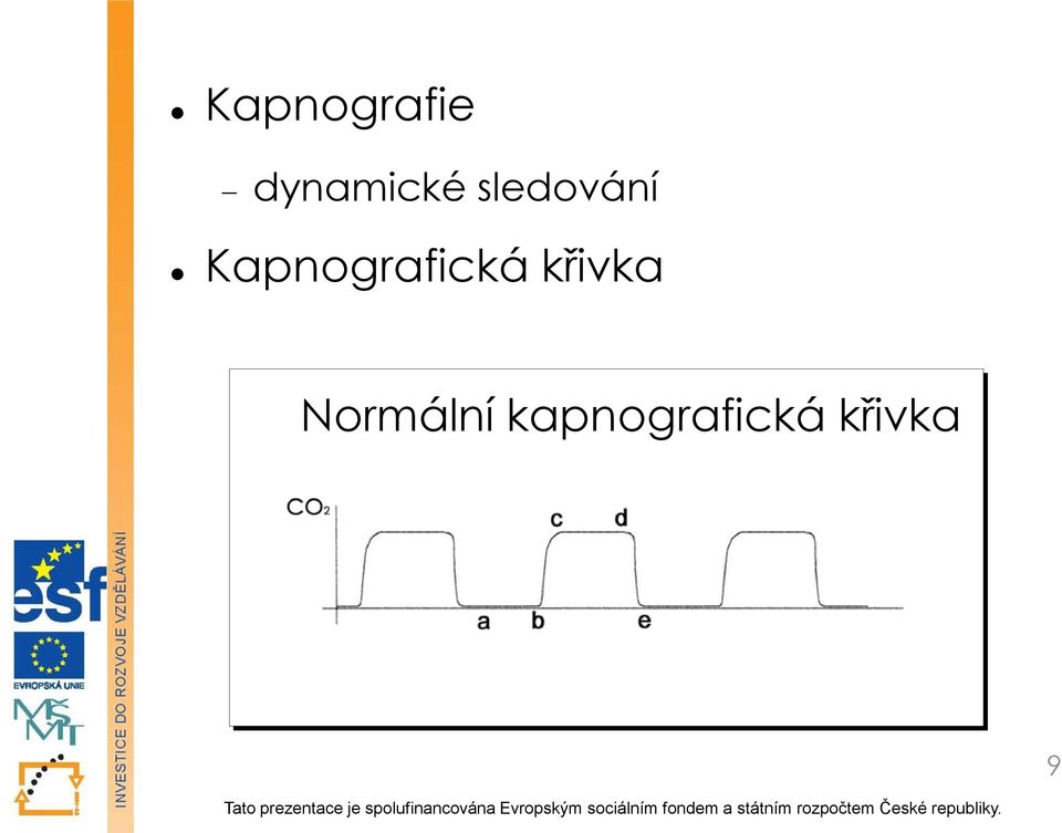 Kapnografická křivka