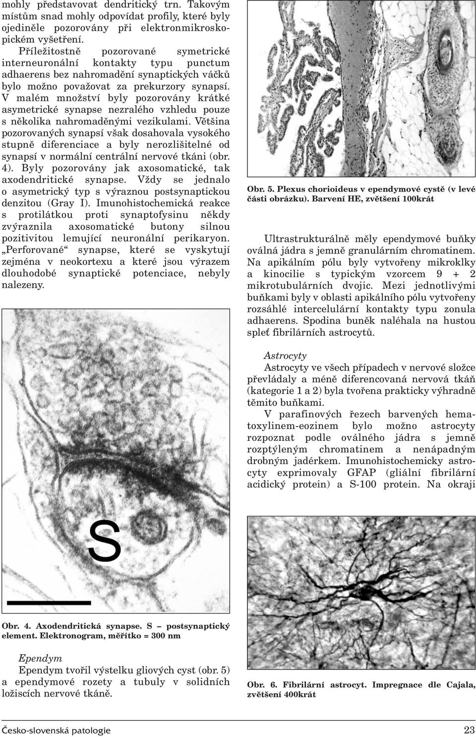 Nervová složka zralých cystických teratomů ovaria - PDF Stažení zdarma