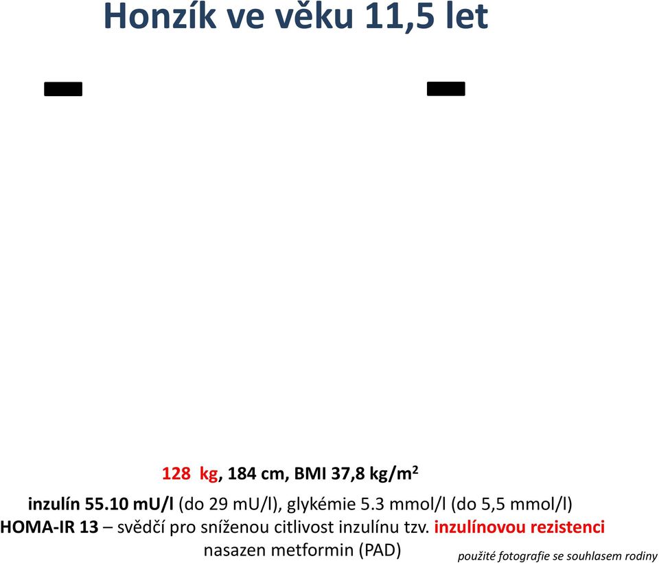 3 mmol/l (do 5,5 mmol/l) HOMA IR 13 svědčí pro sníženou citlivost
