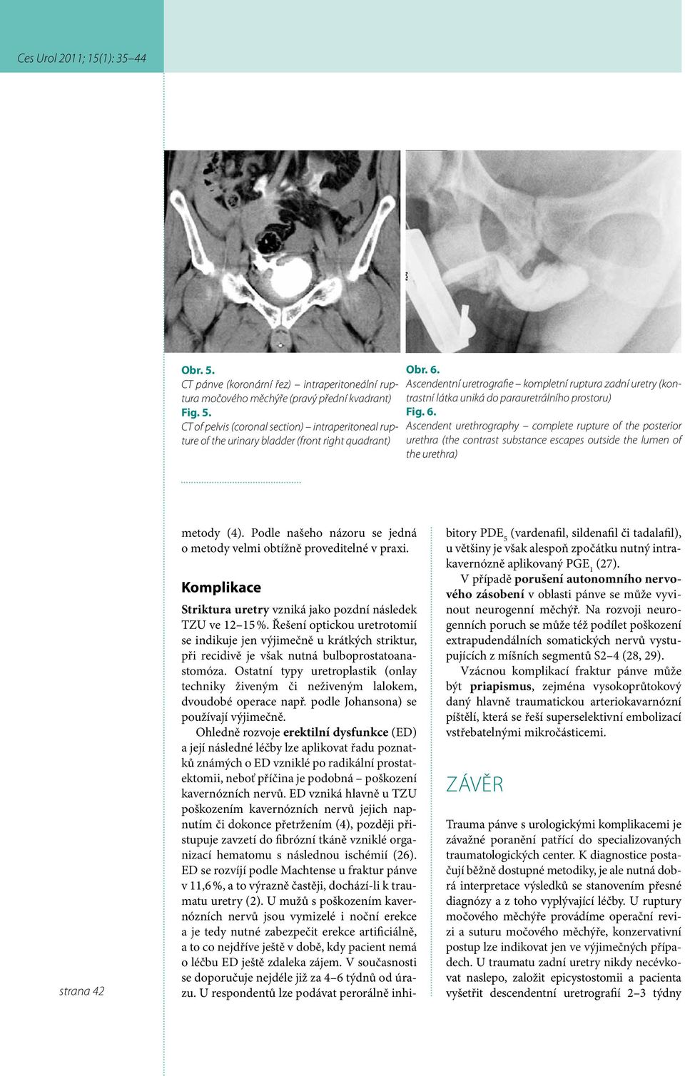 Ascendent urethrography complete rupture of the posterior urethra (the contrast substance escapes outside the lumen of the urethra) strana 42 metody (4).