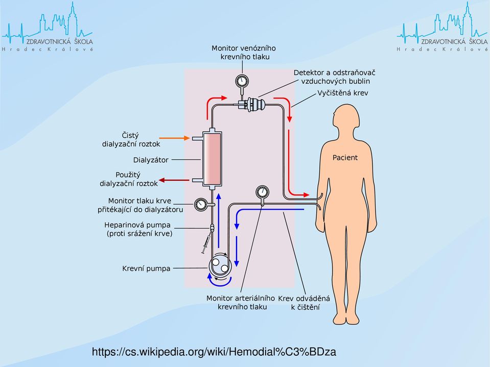 přitékající do dialyzátoru Heparinová pumpa (proti srážení krve) Krevní pumpa Monitor