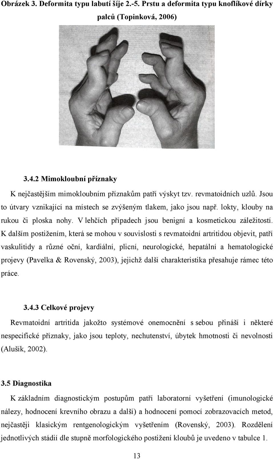 K dalším postižením, která se mohou v souvislosti s revmatoidní artritidou objevit, patří vaskulitidy a různé oční, kardiální, plicní, neurologické, hepatální a hematologické projevy (Pavelka &