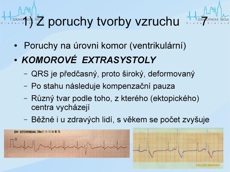 stahu následuje kompenzační pauza Různý tvar podle toho, z kterého