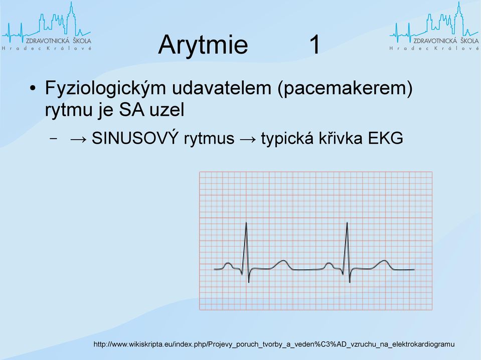 EKG http://www.wikiskripta.eu/index.