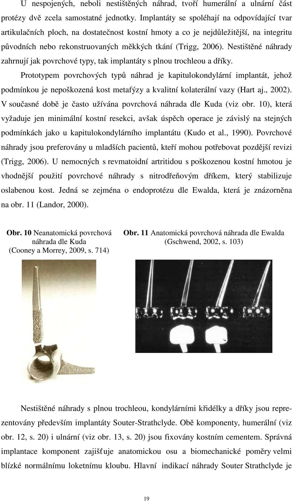 Nestištěné náhrady zahrnují jak povrchové typy, tak implantáty s plnou trochleou a dříky.