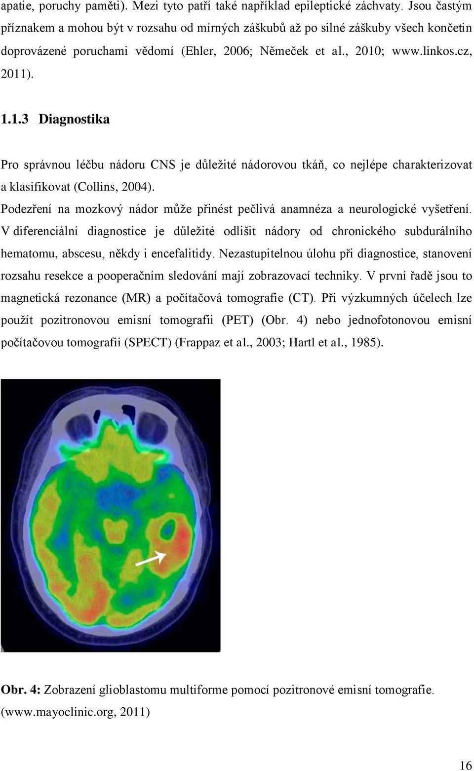 ; www.linkos.cz, 2011). 1.1.3 Diagnostika Pro správnou léčbu nádoru CNS je důleţité nádorovou tkáň, co nejlépe charakterizovat a klasifikovat (Collins, 2004).