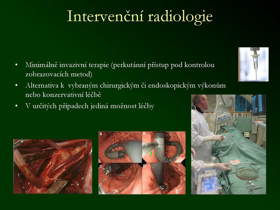 Alternativa k vybraným chirurgickým či endoskopickým