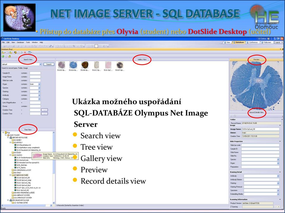 možného uspořádání SQL-DATABÁZE Olympus Net Image Server