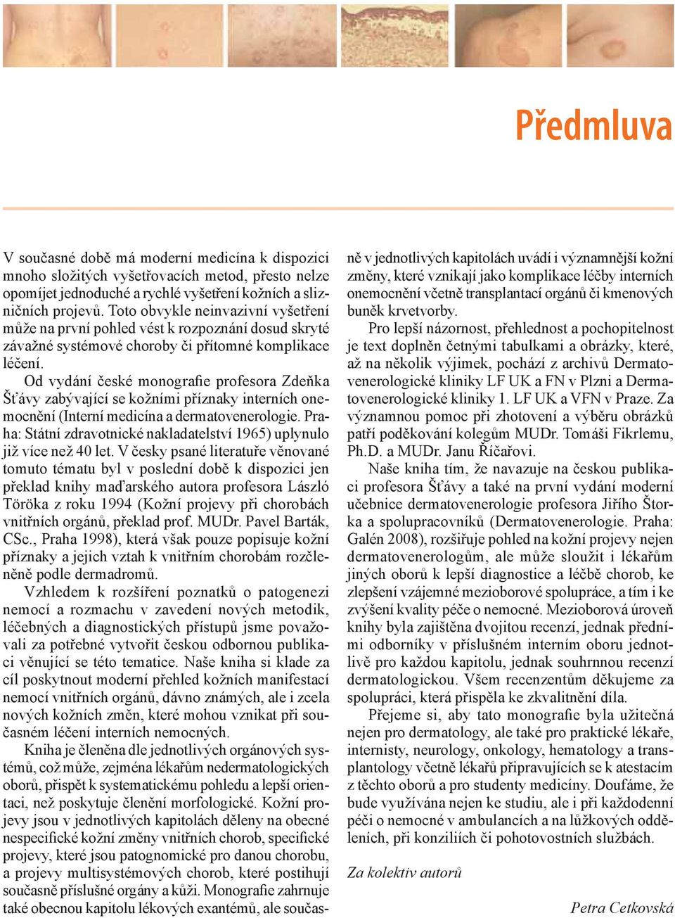 Od vydání české monografie profesora Zdeňka Šťávy zabývající se kožními příznaky interních onemocnění (Interní medicína a dermatovenerologie.