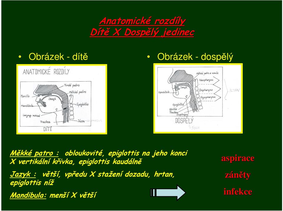 vertikální křivka, epiglottis kaudálně Jazyk : větší, vpředu X