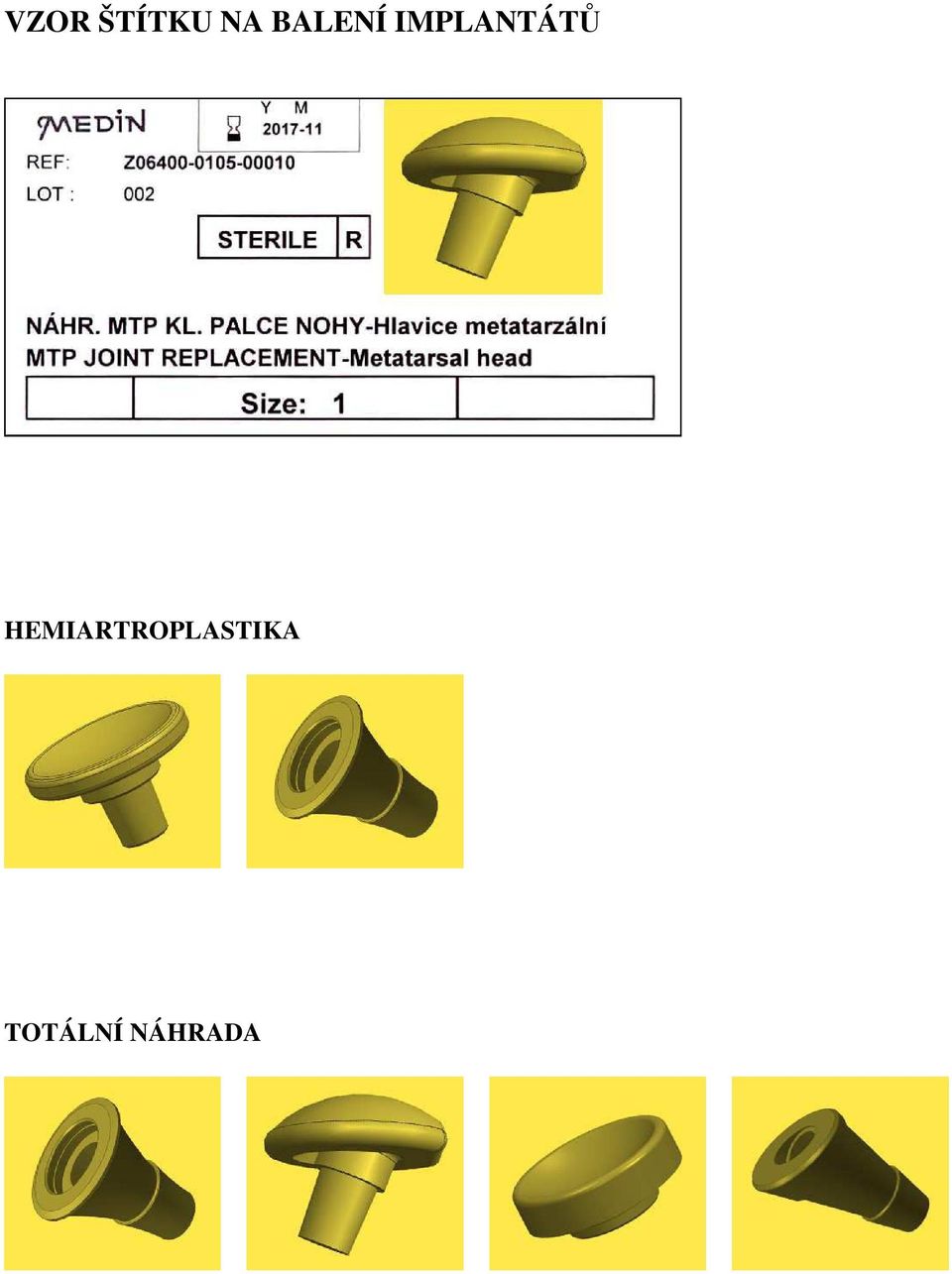 IMPLANTÁTŮ