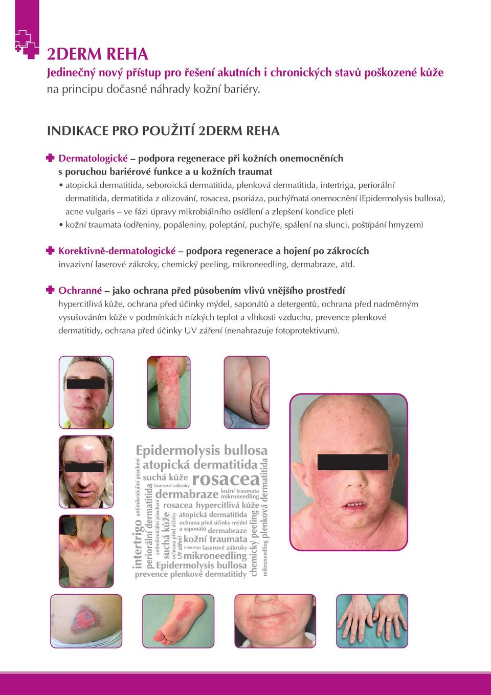 dermatitida, intertriga, periorální dermatitida, dermatitida z olizování, rosacea, psoriáza, puchýřnatá onemocnění (Epidermolysis bullosa), acne vulgaris ve fázi úpravy mikrobiálního osídlení a