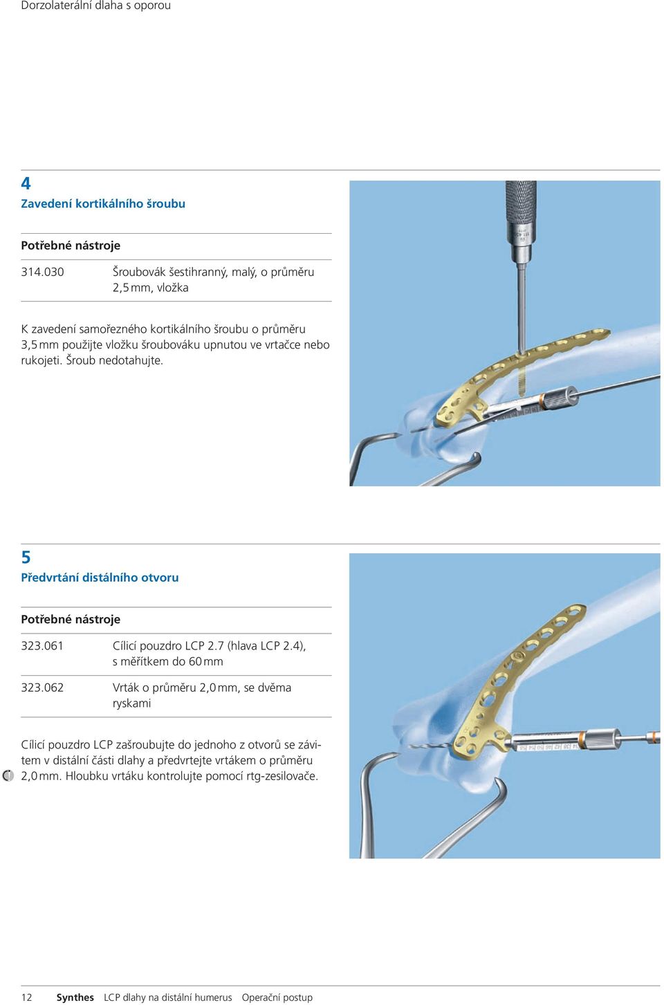 vrtačce nebo rukojeti. Šroub nedotahujte. 5 Předvrtání distálního otvoru 323.061 Cílicí pouzdro LCP 2.7 (hlava LCP 2.4), s měřítkem do 60 mm 323.