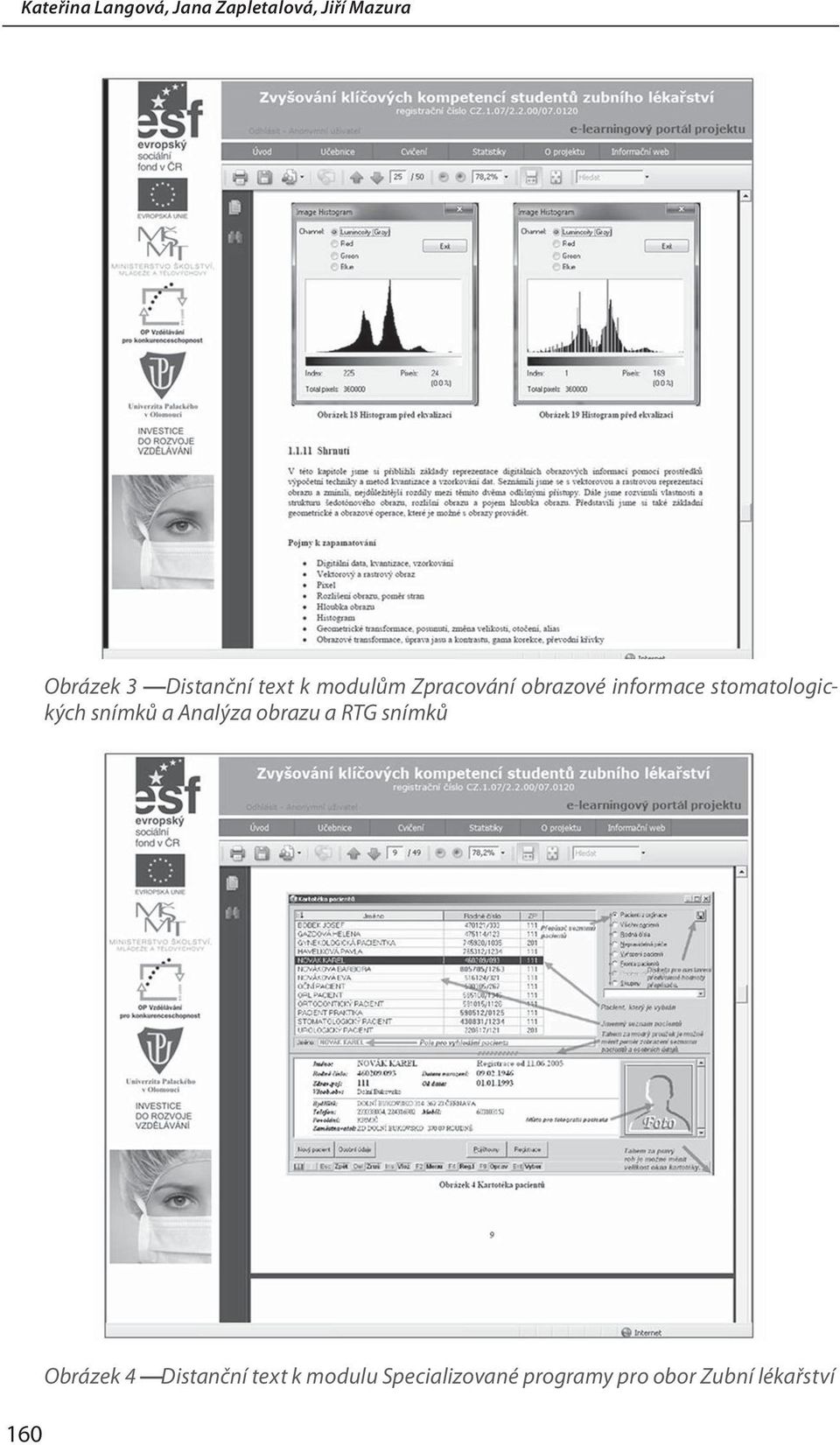 stomatologických snímků a Analýza obrazu a RTG snímků 160