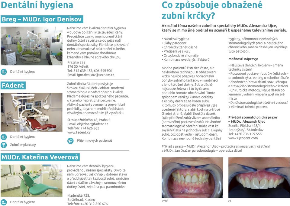 Floridace, pískování nebo ultrazvukové odstranění zubního kamene vám pomůže dosáhnout krásného a hlavně zdravého chrupu. Pražská 528 176 00 Mělník Tel: 315 639 432, 606 549 901 Email: igor.