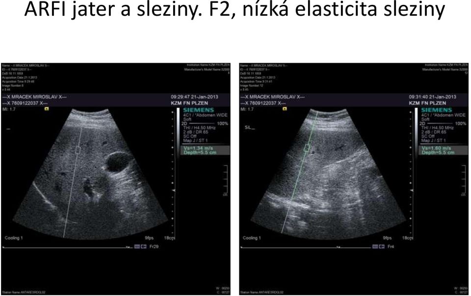 F2, nízká