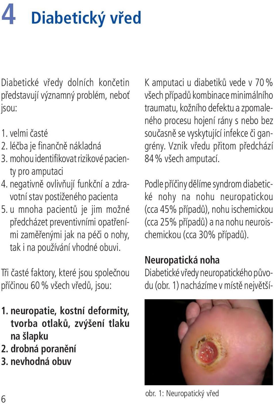 Tři časté faktory, které jsou společnou příčinou 60 % všech vředů, jsou: K amputaci u diabetiků vede v 70 % všech případů kombinace minimálního traumatu, kožního defektu a zpomaleného procesu hojení