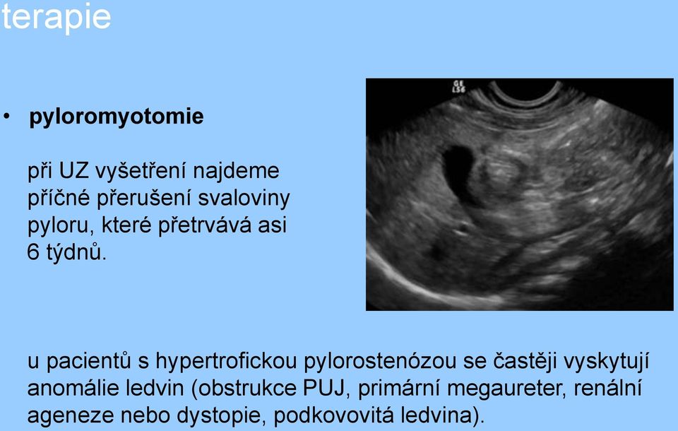 u pacientů s hypertrofickou pylorostenózou se častěji vyskytují