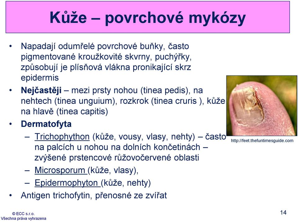 (tinea capitis) Dermatofyta Trichophython (kůže, vousy, vlasy, nehty) často na palcích u nohou na dolních končetinách zvýšené prstencové