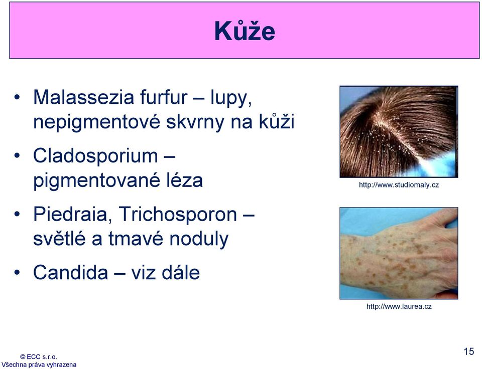 Trichosporon světlé a tmavé noduly Candida viz