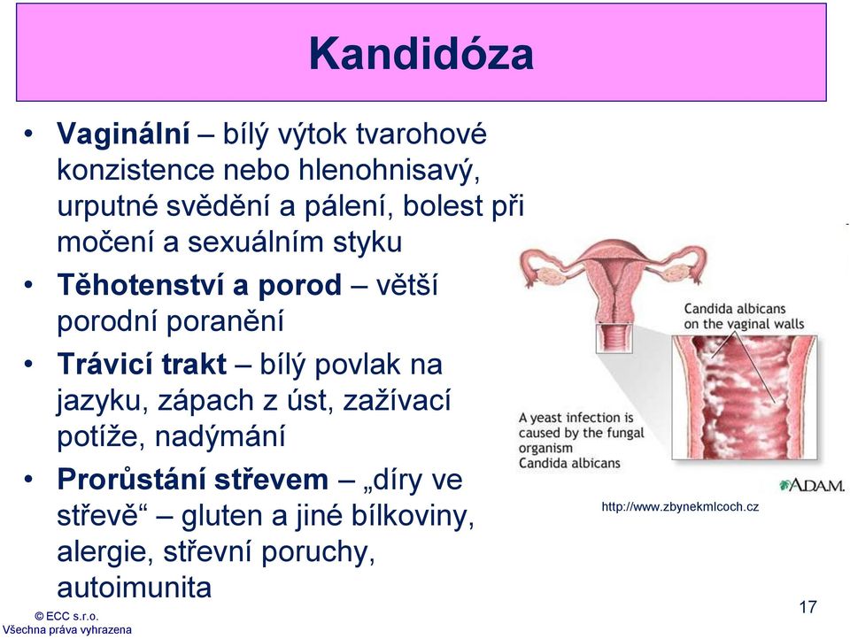 trakt bílý povlak na jazyku, zápach z úst, zažívací potíže, nadýmání Prorůstání střevem díry